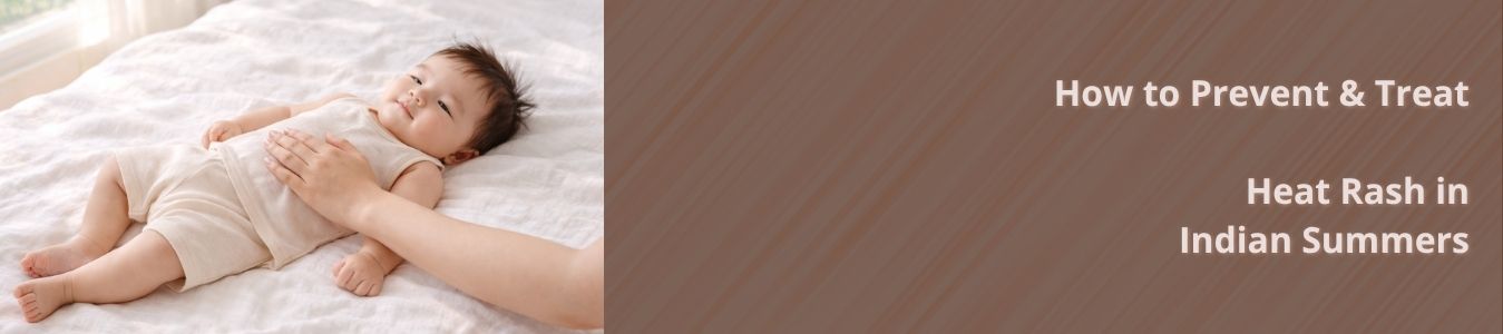 prevent and treat heat rash in indian summers blog main image